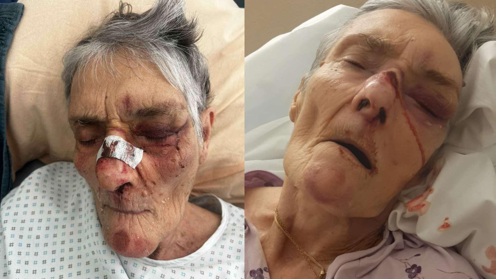 Ehpad à Martigues : la famille de Janine va déposer plainte pour maltraitance